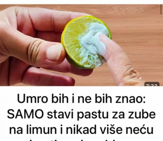 Umro bih i ne bih znao: SAMO stavi pastu za zube na limun i nikad više neću imati ovaj problem